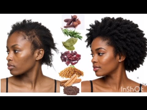 From THIN TO THICK HEALTHY HAIR FAST. #naturalhair #thickhair.
