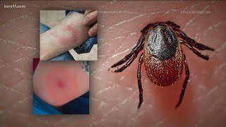 Local firefighter warns about the dangers of Lyme disease