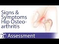 Signs and Symptoms of Hip Osteoarthritis