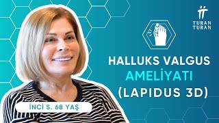 Başparmak Çıkıntısı Ameliyatı Olanların Yorumları İnci Hanım Lapidus 3D Halluks Valgus Ameliyatı