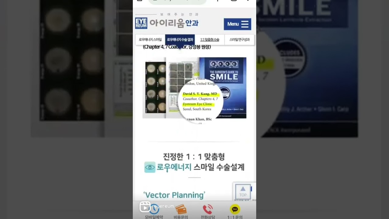 [Айриум Нүдний эмнэлэг] СМАЙЛ ЛАСИК-ийн сэтгэгдэл: Мэс заслын 2 дахь өдрөөс эхлэн өдөр тутмын амьдрал боломжтой (Оролцсон: Бага энергитэй СМАЙЛ)