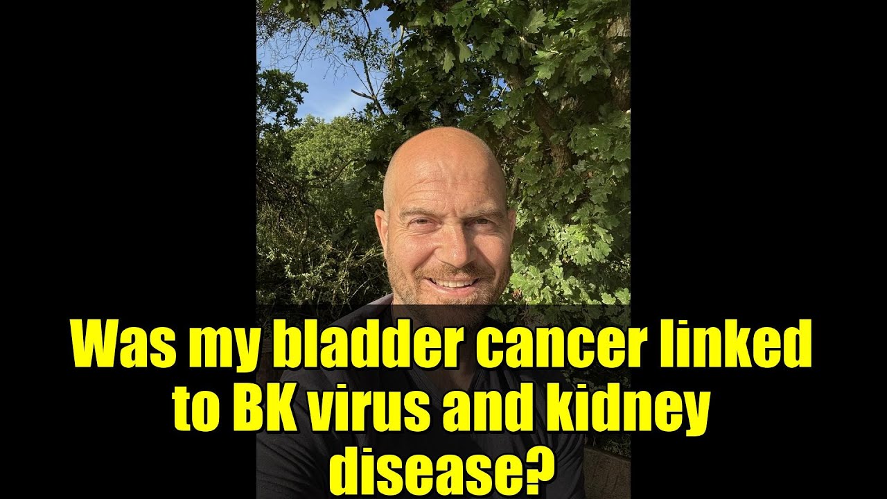 Была ли моя раковая инфекция мочевого пузыря связана с вирусом BK и заболеванием почек? | История...