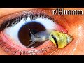 r/Hmmm | eye snail