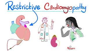 Restrictive Cardiomyopathy | Causes, Symptoms, Diagnosis & Treatment | Cardiology Series