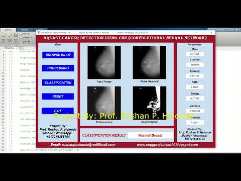 CNN Breast Cancer Identification Using Matlab Project With Source Code | Breast Cancer Detection