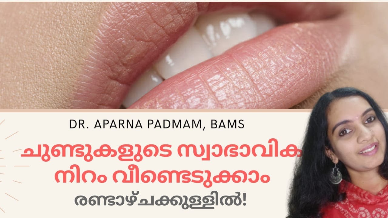 Lip pigmentationLip darknessReasons & Home RemediesMalayalam YouTube