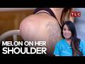 Jackie Has A Melon Sized Bump On Her Shoulder | Dr Pimple Popper S3 Ep1 | TLC India