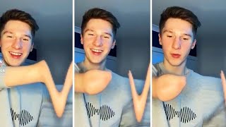 Guy Loses Arm Thanks to TikTok Filter