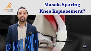 Jiffy Knee Replacement Surgery Explained | Muscle-Sparing Knee Replacement (Faster Recovery!)
