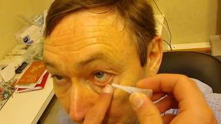 0 5 Tropicamide Against 0 05 Tropicamide