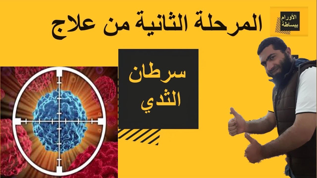 المرحلة الثانية من علاج سرطان  الثدي