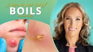 Boils | 9 Tips to Get Rid of Boils Naturally | Dr. J9 Live