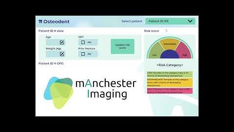 Osteodent AI - Product Concept