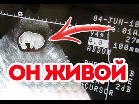 Как шевелится котенок в животе, определяем беременность кошки. - YouTube