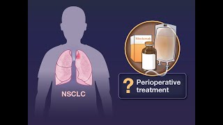 Perioperative Nivolumab in Resectable NSCLC | NEJM