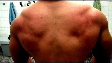 Build Amazing Back Muscles Naturally!!! @hodgetwins