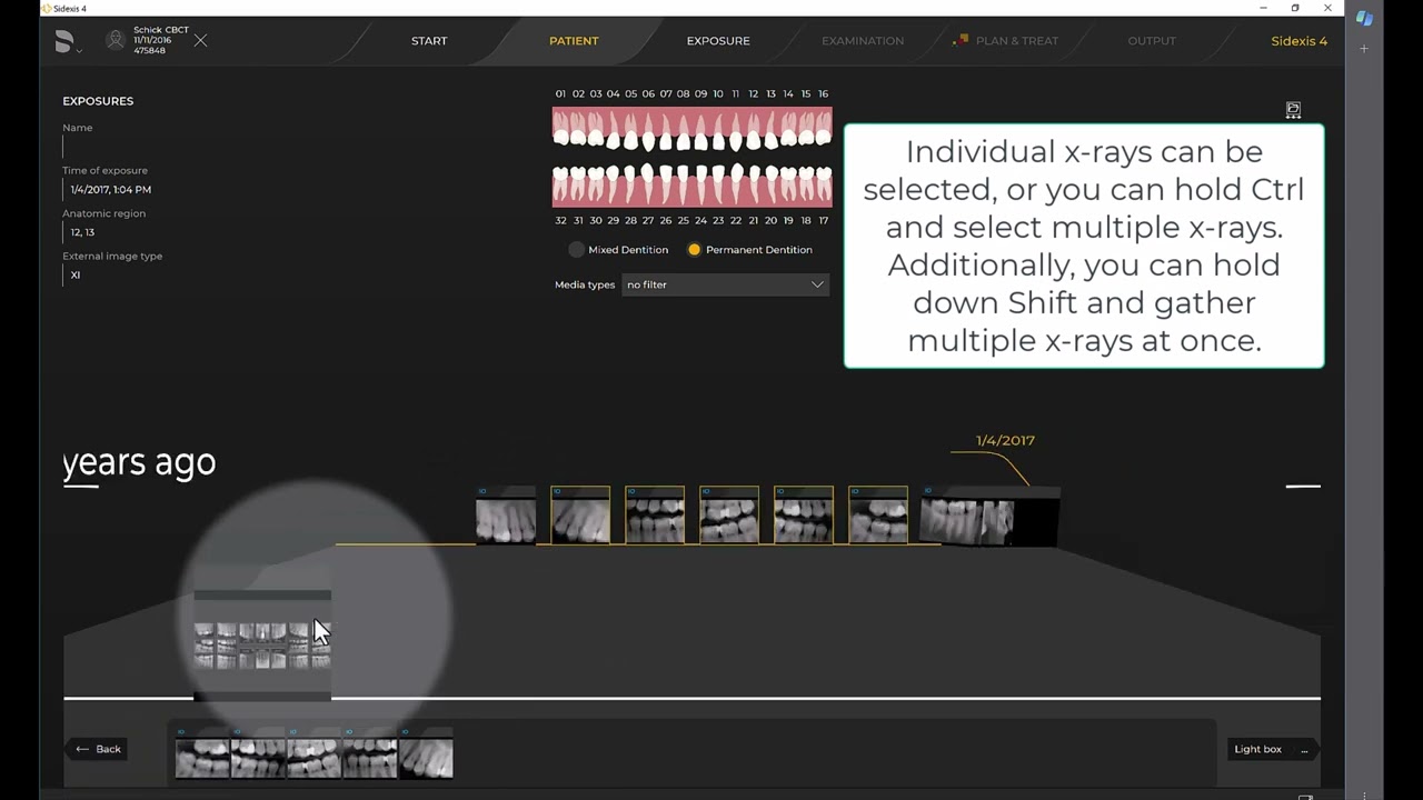 Imaging Training Session 12: Sidexis 4 - Schick Exam Light Box