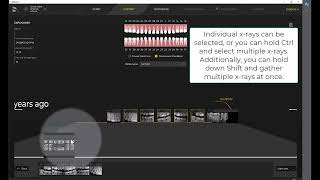 Imaging Training Session 12: Sidexis 4 - Schick Exam Light Box