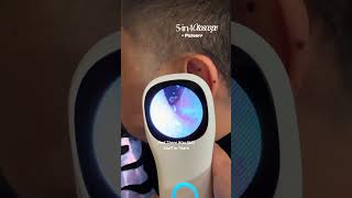 5 in 1 Otoscope #otoscope #earcare #eartips #selfcare #musthaveitems #usefulgadgets #selfcaretools