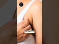 Underarm Bulge in Sleeveless Dresses? Axillary Breast Explained by Dr. Gautam Chaudhury In India