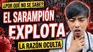 Alerta por sarampión: un médico explica los síntomas que pocos conocen y por qué nadie habla de esto