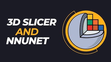 Integrate Your nnUNet Model in 3D Slicer