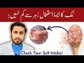 How Salt Can Destroy Your Health Zyada Salt Khane Ke Nuksan By Dr Zeeshan 