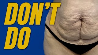 11 Things You Should NOT Do After a Tummy Tuck screenshot 4