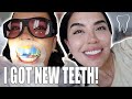 MY TEETH JOURNEY |  BEFORE VENEERS AND AFTER