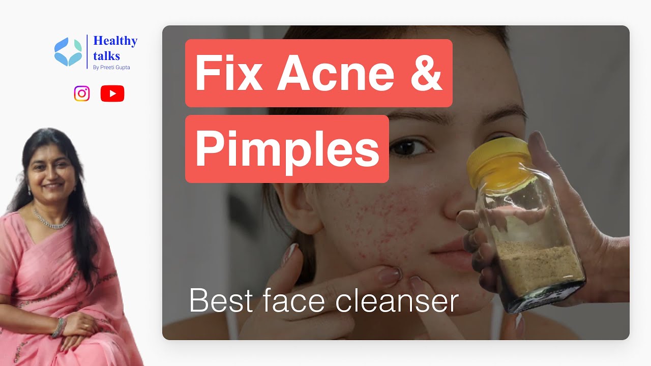 Does Dandruff Causes Acne? Learn to Make Homemade Face Cleanser for