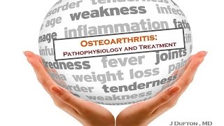 Osteoarthritis: Pathophysiology and Treatment