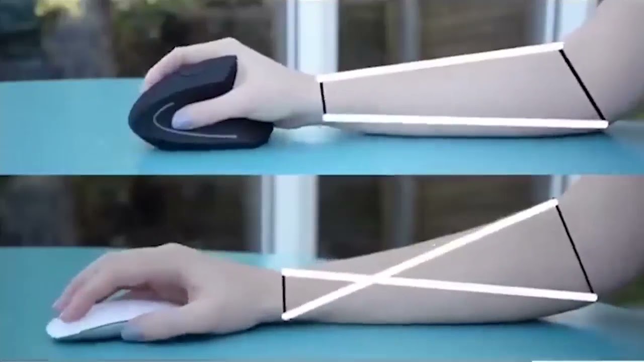 Ergonomic Vertical Wireless mouse handshake position, Preventing forearm twisting