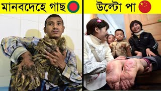 দুনিয়ার সবচেয়ে অদ্ভুত মানুষ যাদের দেখলে অবাক হবেন | 15 People You Won't Believe Exist