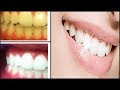 2 Dakikada Sararmış Dişlere Çözüm - DİŞ Nasıl BEYAZLATILIR? EVDE Diş BEYAZLATMA
