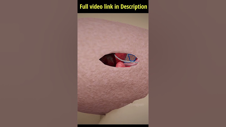 | Male sterilization | Family planning|  #reproduction