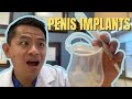 Penis Implants for Erectile Dysfunction