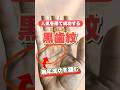 【手相】人気を集める黒歯紋の手相 #手相  #手相占い  #占い
