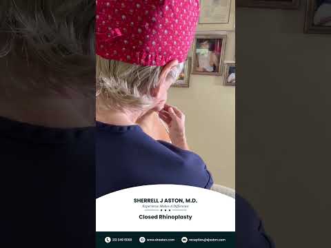 Video thumbnail: A rhinoplasty is a life changing event regardless of the patient’s age | Dr. Sherrell Aston · Sherrell J. Aston, M.D. Aesthetic Plastic Surgery