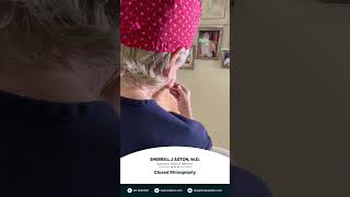 A rhinoplasty is a life changing event regardless of the patient’s age | Dr. Sherrell Aston