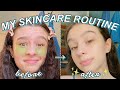 MY SKINCARE ROUTINE 2021 to get clear and glowing skin !!