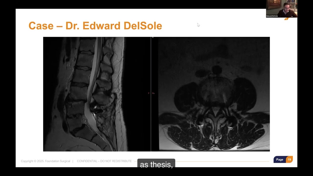 Identifying the Ideal VBO Patient: Clinical Decision Making with Dr. Edward DelSole