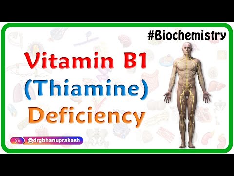 Vitamin B1 Thiamine Deficiency Usmle Biochemistry Vitamins Case Based Discussion