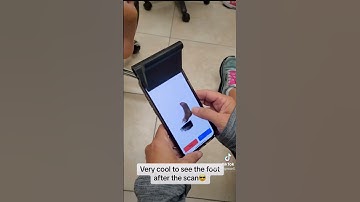 "Revolutionizing: 3D Printed Orthotics at Center for Ankle & Care!" #shorts #customorthotics