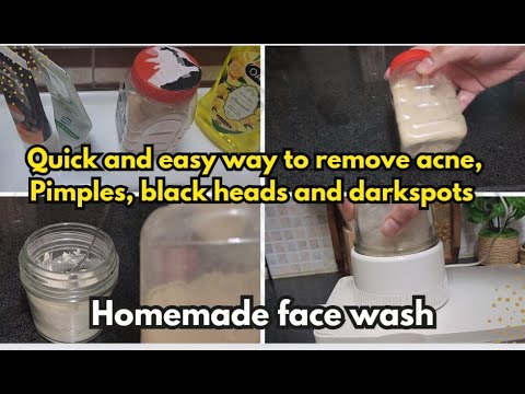 3 Ways to Clear Mild Acne Fast - wikiHow Health