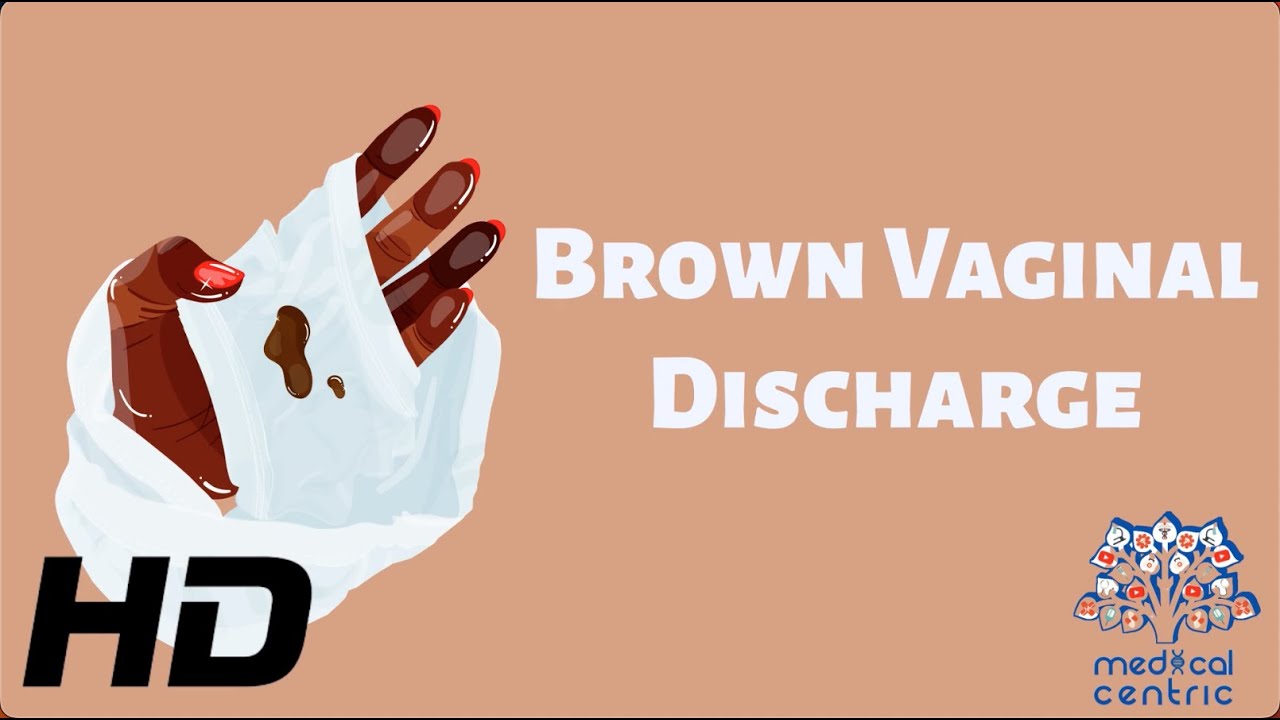 This Is Why Your Vaginal Discharge Is Brown