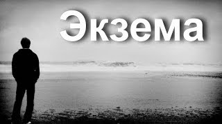 Экзема лечение на руках и ногах. Как вылечить экзему народными средствами в домашних условиях Экзема лечение на руках и ногах. Как вылечить экзему народными средствами в домашних условиях