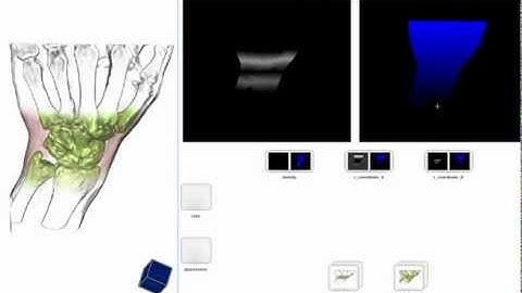Semantics by Analogy for Illustrative Volume Visualization