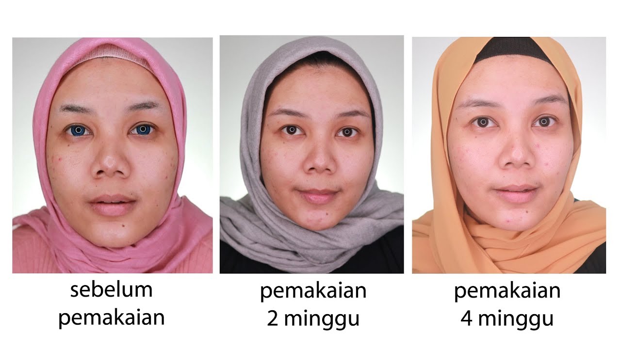 review avoskin eye serum