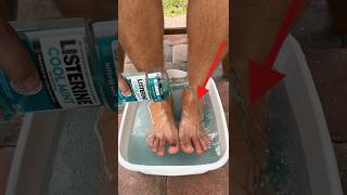 I Soaked My Feet in Listerine for 15 Minutes and Was Shocked screenshot 3