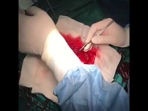 جراحی مغز و اعصاب    دکتر محسن القاسی
